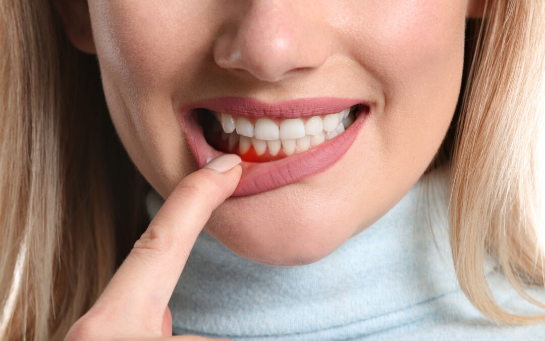 Gum Disease Treatment in Coweta, OK: Your Path to Oral Health Wellness