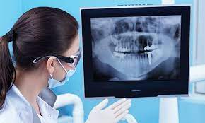 Information Collected from Dental X-Rays