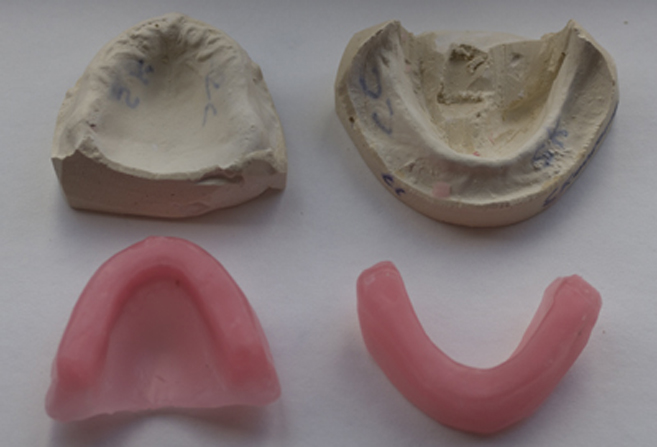 The Process of Acquiring Fixed Dentures: A Step-by-Step Guide