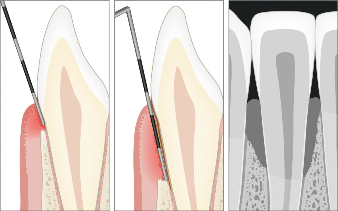 Treating Disorders Diagnosed During Periodontal Exams