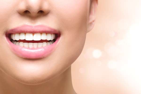 The Tooth Bonding Process: A Stepwise Guide