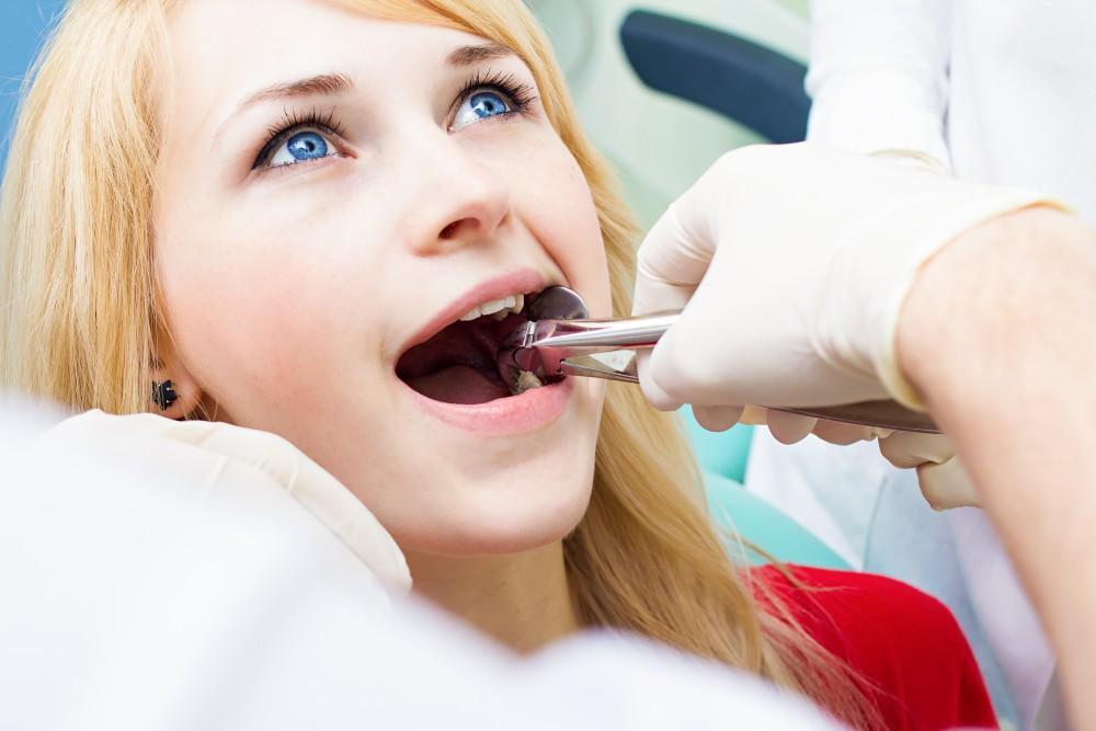 When You Should Opt for Tooth Extraction